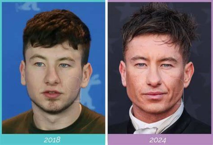 Barry Keoghan Profile Images &mdash; The Movie Database (TMDb)
