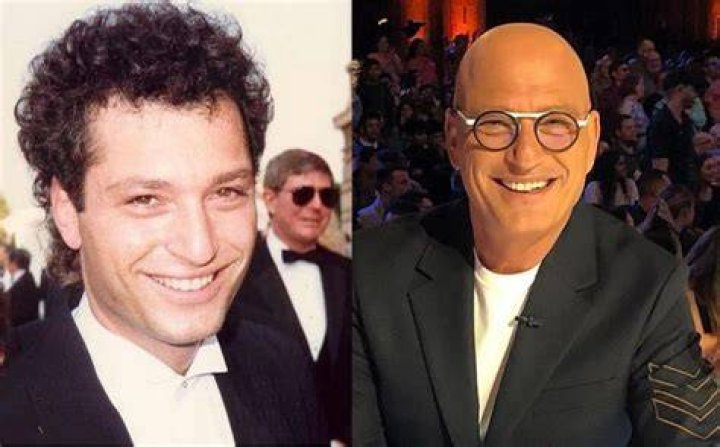 Did Howie Mandel Ever Have Hair? Why is He Bald?