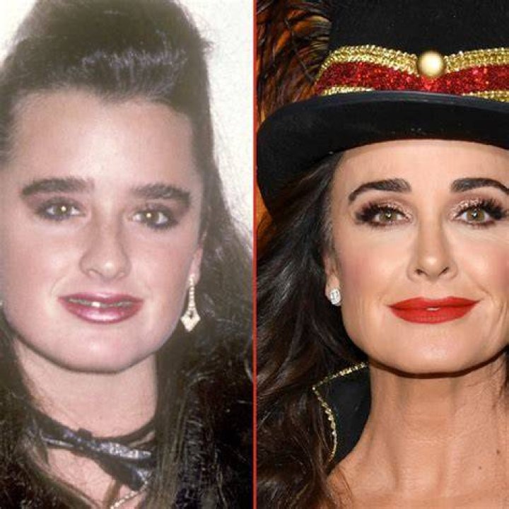 ExLover of Kyle Richards' Lesbian Girlfriend Exposes Secret Romance