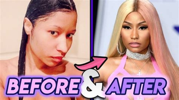 Nicki Minaj Before And After Skin Bleaching