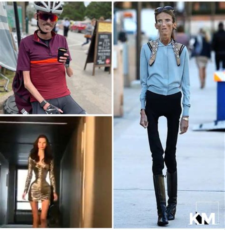 Skinniest Person 2021 Top 5 Skinniest People in the World