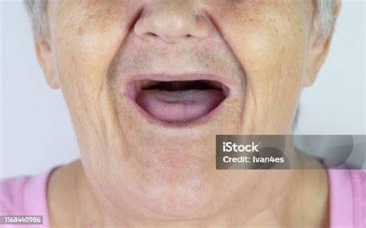 Toothless mouth. An elderly woman with no teeth. Old Granny with her
