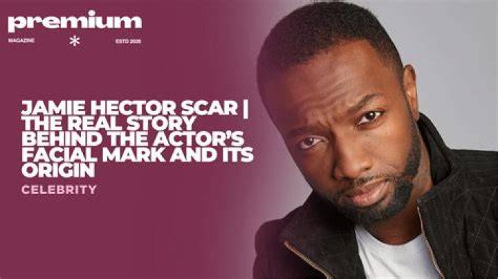 Uncovering The Origin Of Jamie Hector's Iconic Scar