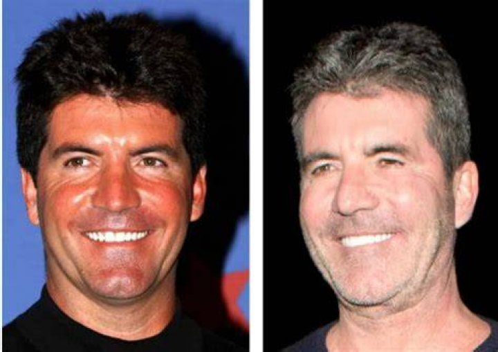 Understanding Simon Cowell's Son Condition: A Journey Through Parenthood