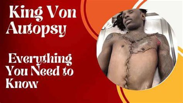 What does King von Autopsy say? Let's discover the real cause of his